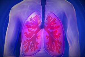 lungs and respiratory system - radon gas cause lung cancer-800